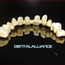 DentalAlliance GbR